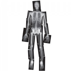 Image of Human X-Rays on Film