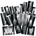 Thumbnail Image #2 of Human X-Rays on Film