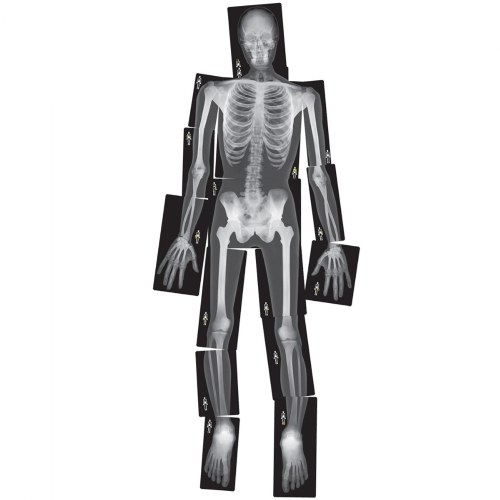Human X-Rays on Film