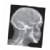 Alternate Image #1 of Broken Bones X-Rays