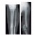 Alternate Image #3 of Broken Bones X-Rays