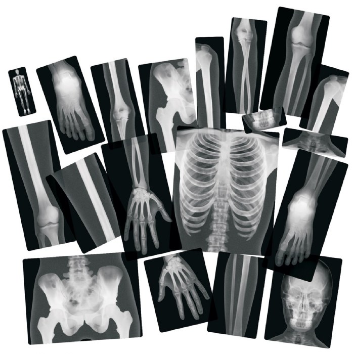 Alternate Image #1 of Human X-Rays on Film