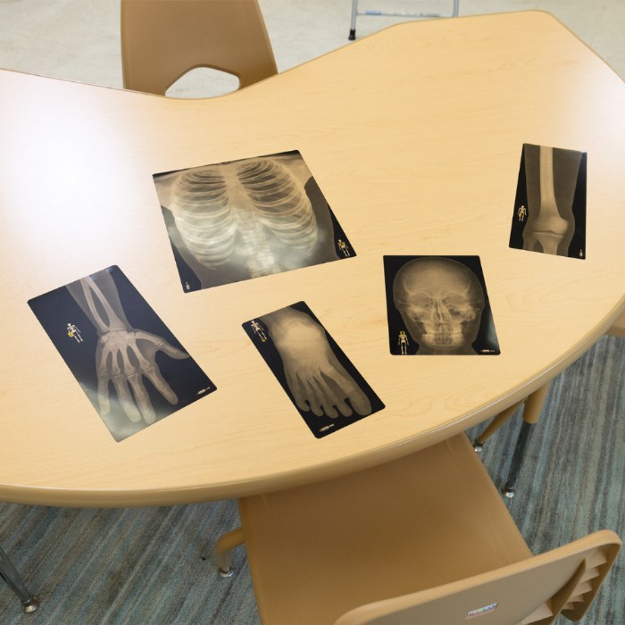Alternate Image #1 of Human X-Rays on Film
