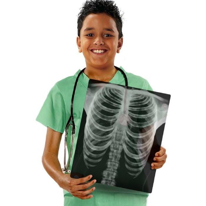 Alternate Image #1 of Human X-Rays on Film