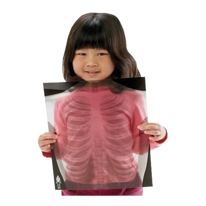 Alternate Image #1 of Human X-Rays on Film