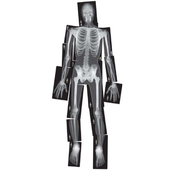 Primary Image of Human X-Rays on Film