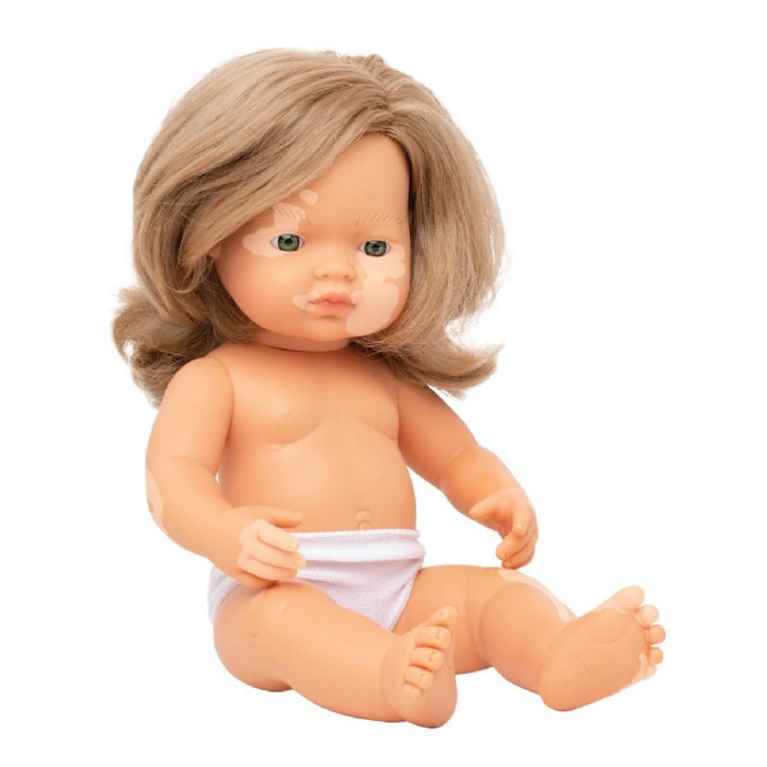 Primary Image of Doll with Vitiligo 15"