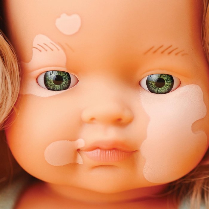 Alternate Image #1 of Doll with Vitiligo 15"