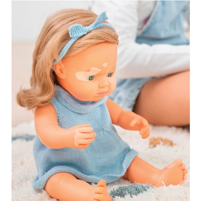 Alternate Image #1 of Doll with Vitiligo 15"