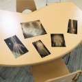 Alternate Thumbnail #8 of Human X-Rays on Film
