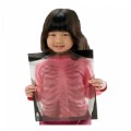 Thumbnail Image #2 of Human X-Rays on Film