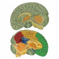 Alternate Image #2 of Human Brain Model
