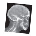 Alternate Image #2 of Broken Bones X-Rays